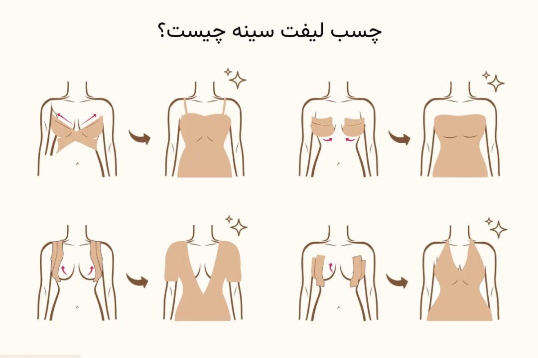 چسب لیفت سینه چیست
